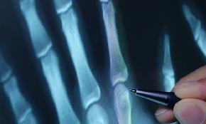 E discovery Looks to Tame Next Frontier: Medical X Rays
