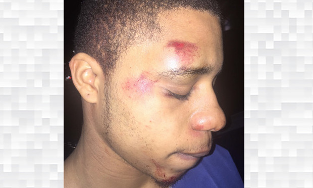 Rodney Williams Jr., his attorney said was a victim of a police taser. Williams was struck with the taser from behind and broke his fall with his jaw.