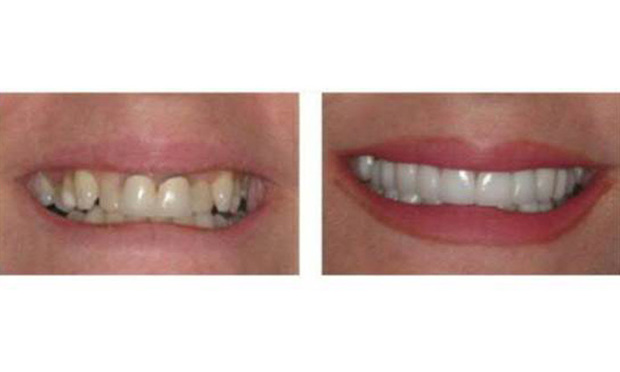 Dentist Mitchell Pohl's patient teeth before and after. Courtesy photo.
