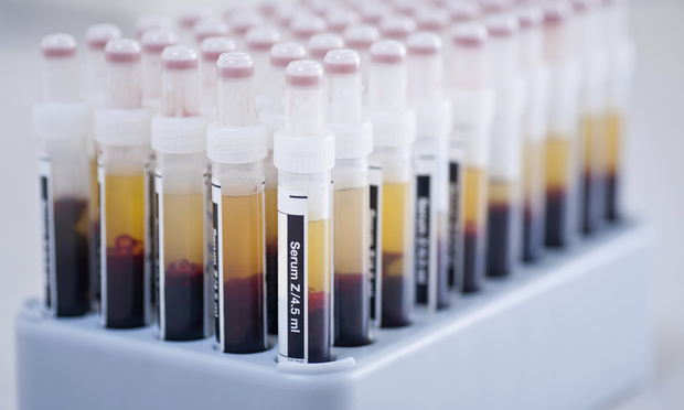 Blood test samples/photo by Ingus Bajars